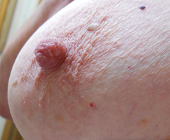 Photo #2 - Nipple Study:  Linda has the most sensitive nipples I ever come ...