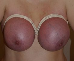 Different types of breast bondage on a willing model