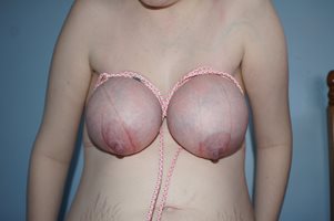 Recently Post Preggo  Breast Bondage toy.  Tit release