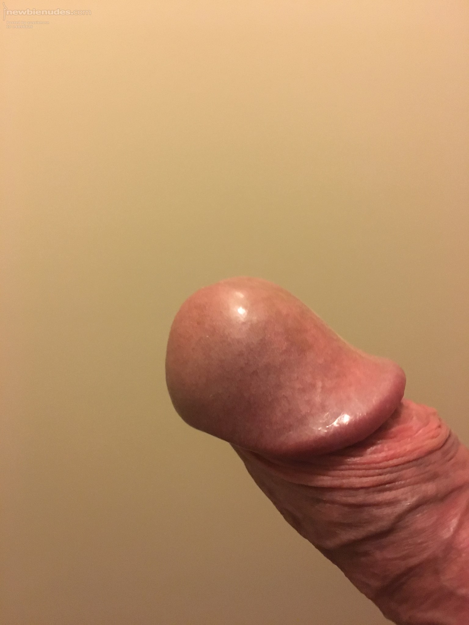 My Cock head, Please comment