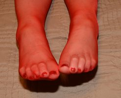 CFM red toes,....