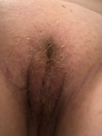 My pussy is getting hairy