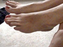 Smelling between my wife's pinky toes sometimes smells vinegary and sometim...