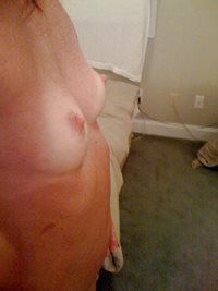 Breasts Side View
