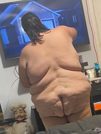 Back fat and cellulite ass
