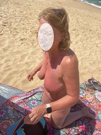 Sunburnt titties, who want to rub some lotion on them?