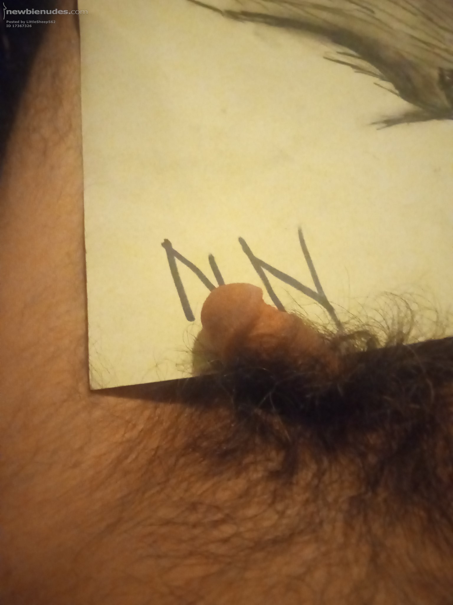 Just about to shave baby bird. Been awhile with surgery. Gonna do B4 and after. Trust me it's needed