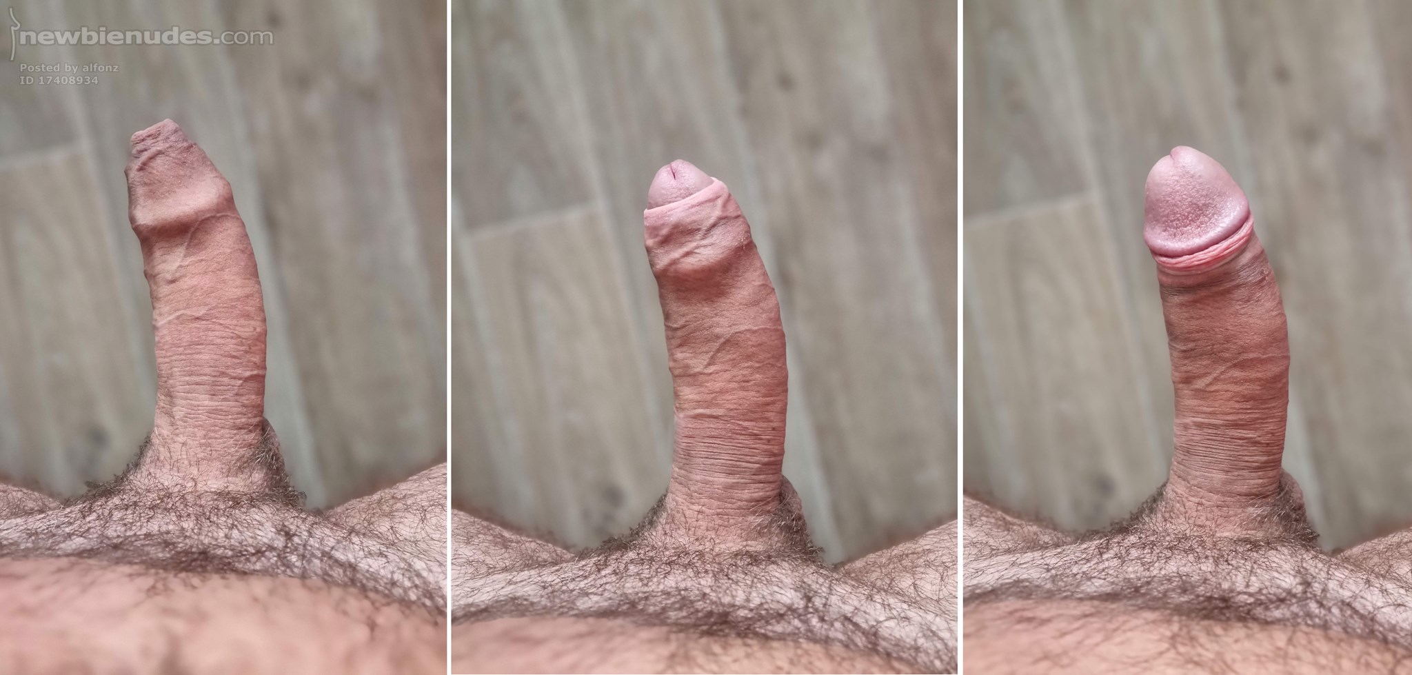 Pulling my foreskin back a bit to reveal the head...  