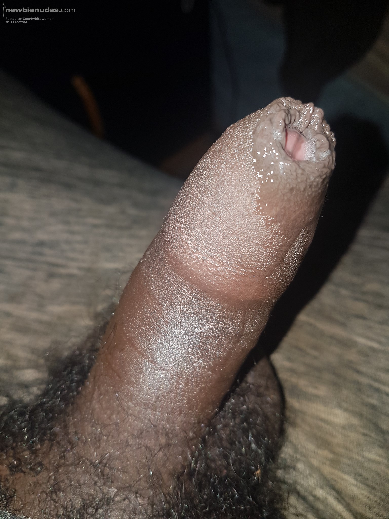 Uncut, foreskin