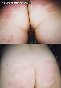 Katherine's red ass after a belt spanking.