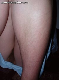 My hairy legs