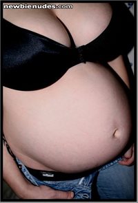 My best friend Sarah is pregnant now! She got the same kind of umbilical as...