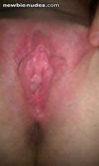 Red swollen pussy after being fucked by two guys