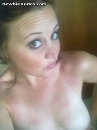 Still Burnt.. and still needing someone to rub aftersun on me.. Any offers?...