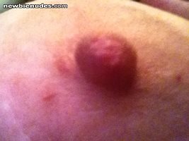 my nipple in heat
