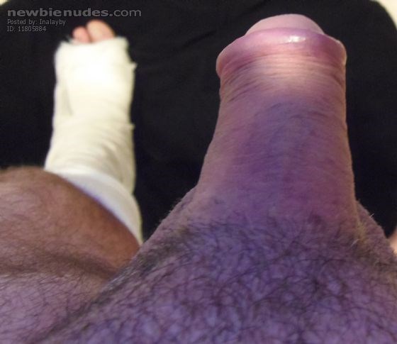 Nice gentle Nurse required.........lol