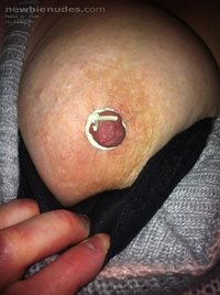 My nipple tied with elastic band