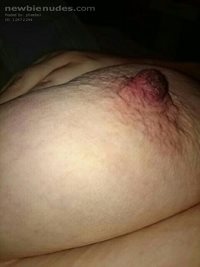 After nipple suckers