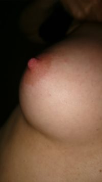 Hard nipple